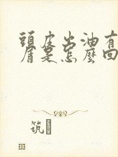 头皮出油有头皮屑是怎么回事