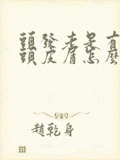 头发老是有很多头皮屑怎么回事