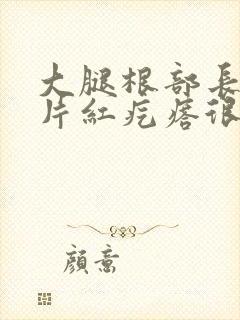 大腿根部长了一片红疙瘩很痒