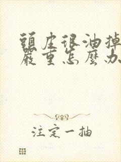 头皮很油掉发很严重怎么办