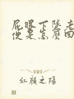 屁眼下坠老想大便是怎么回事啊封面