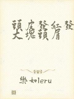 头皮发红发痒有大块头屑