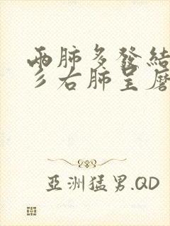 两肺多发结节景彡右肺呈磨玻璃状