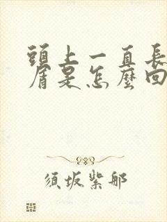 头上一直长头皮屑是怎么回事