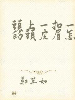 头上一扣一块块的头皮屑怎么办