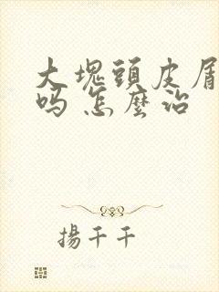 大块头皮屑是癣吗 怎么治