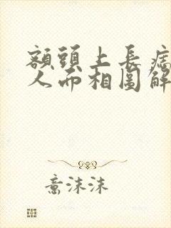 额头上长痣的女人面相图解