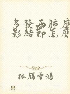 多发两肺磨玻璃影结节怎么办