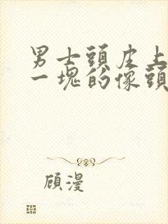 男士头皮上一块一块的像头皮屑是什么原因封面