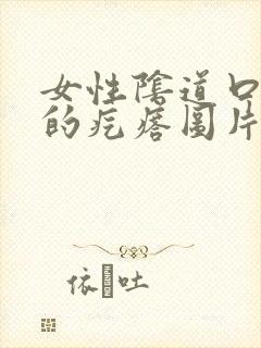 女性阴道口息肉的疙瘩图片