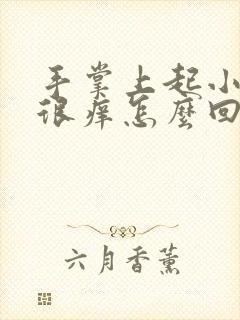 手掌上起小疙瘩很痒怎么回事