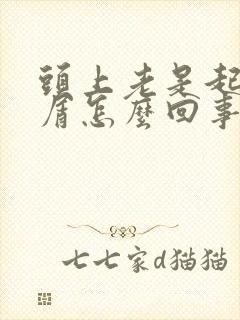 头上老是起头皮屑怎么回事