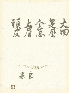 头上全是大块头皮屑怎么回事