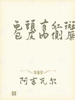 龟头有红斑瘙痒包皮内侧糜烂