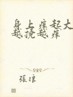 身上痒起大疙瘩越挠越痒