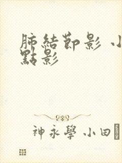 肺结节影 小斑点影