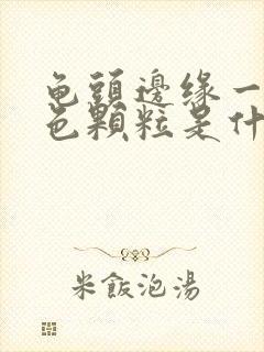 龟头边缘一圈白色颗粒是什么