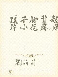 孩子脚背起了一片小疙瘩,痒怎么办