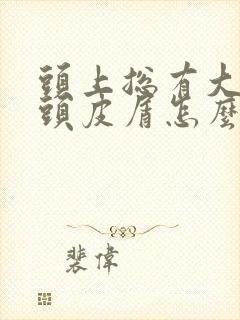 头上总有大块的头皮屑怎么回事