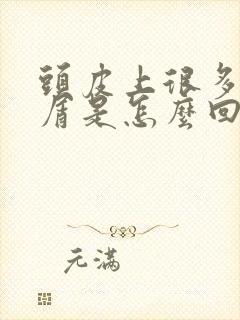 头皮上很多头皮屑是怎么回事