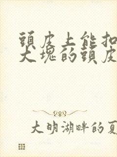 头皮上能扣下来大块的头皮屑