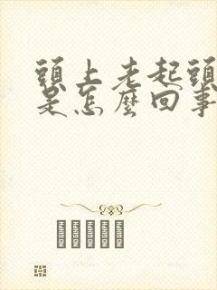 头上老起头皮屑是怎么回事