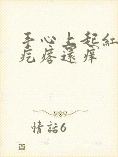 手心上起红色大疙瘩还痒封面