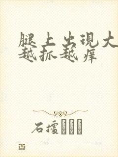 腿上出现大疙瘩越抓越痒封面