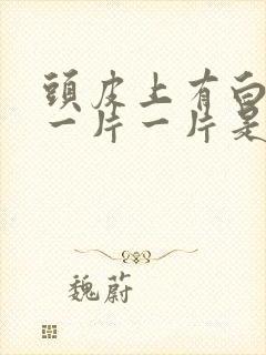 头皮上有白色的一片一片是什么原因封面