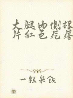 大腿内侧根部一片红色疙瘩痒