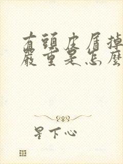 有头皮屑掉头发严重是怎么回事