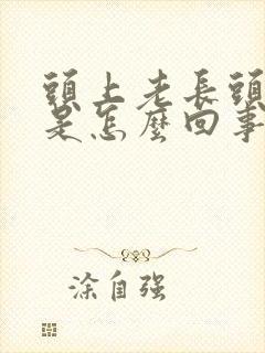 头上老长头皮屑是怎么回事