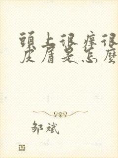 头上很痒很多头皮屑是怎么回事