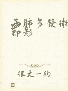 两肺多发微小结节影