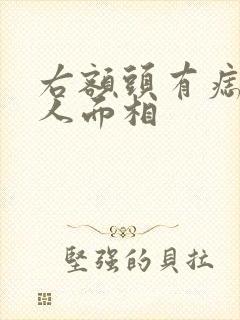 右额头有痣的女人面相