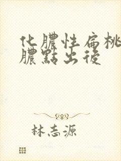 化脓性扁桃体炎脓点出后