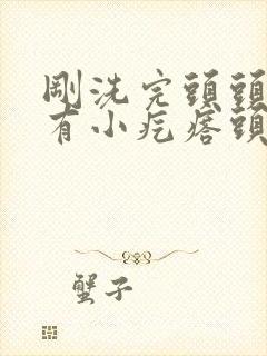 刚洗完头头上就有小疙瘩头皮屑