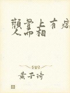 颧骨上有痣的女人面相