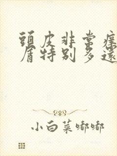 头皮非常痒头皮屑特别多还掉发封面