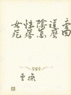 女性阴道旁边长疙瘩怎么回事