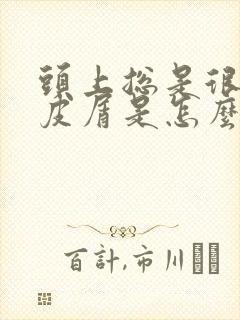 头上总是很多头皮屑是怎么回事