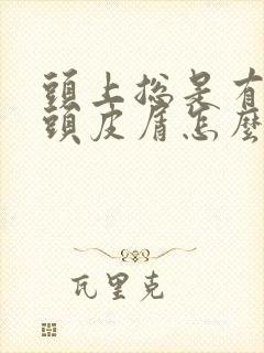 头上总是有很多头皮屑怎么回事