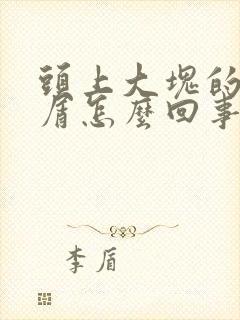 头上大块的头皮屑怎么回事