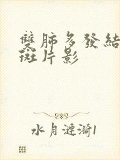 双肺多发结节及斑片影