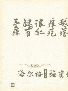 手腿很痒越抓越痒有红疙瘩封面