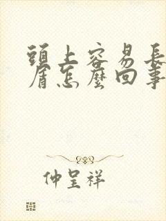 头上容易长头皮屑怎么回事