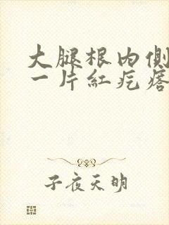 大腿根内侧起了一片红疙瘩