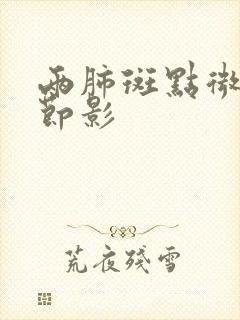 两肺斑点微小结节影