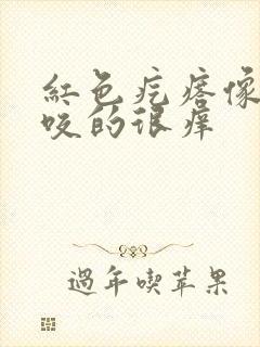 红色疙瘩像蚊子咬的很痒