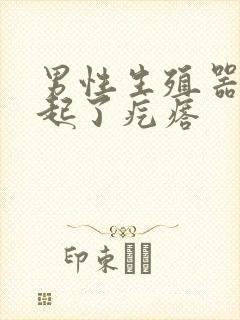 男性生殖器根部起了疙瘩封面